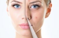روش های داشتن پوست سالم