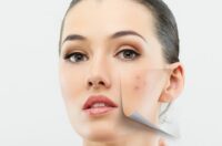 مشکل پوستی در هر نقطه از صورت شما چه می‌گوید؟ طب سنتی چینی پاسخ می‌دهد