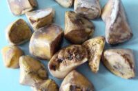 سنگ کیسه صفرا از عوارض مصرف زردچوبه