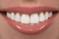 راز داشتن یک لبخند زیبا و جذاب در این چند کار ساده است