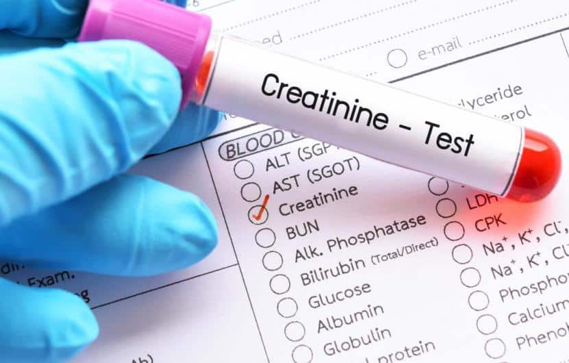 تست کراتینین (creatinine) آزمایش خون چیست و میزان نرمال آن چقدر است؟ تست کراتینین (creatinine) آزمایش خون چیست و میزان نرمال آن چقدر است؟