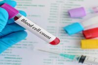 تست RBC آزمایش خون