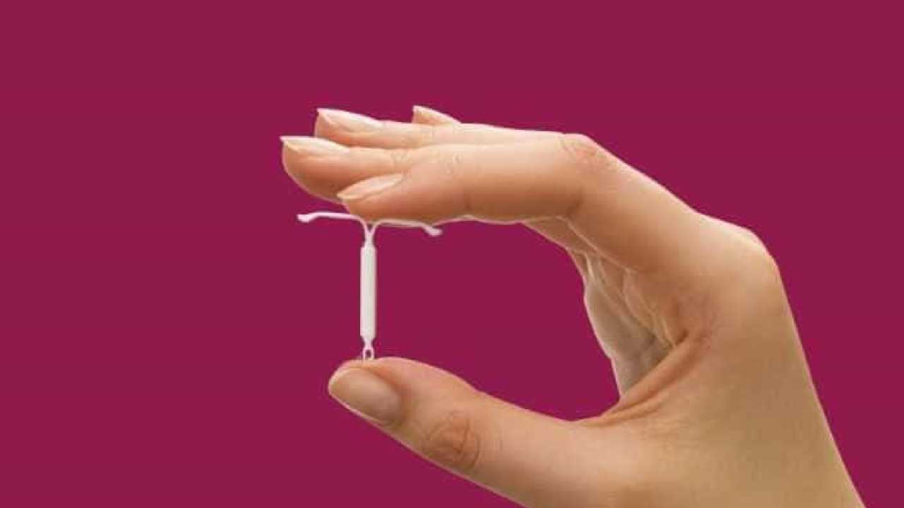 استفاده از میرنا (Mirena) برای جلوگیری از بارداری استفاده از میرنا (Mirena) برای جلوگیری از بارداری