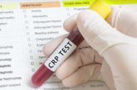 ضرورت تست CRP