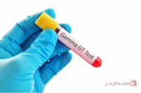 تست GGT