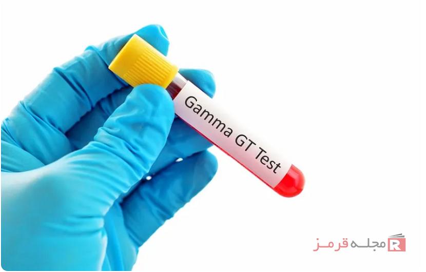 تست GGT