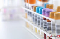 آزمایش خون قبل از جراحی