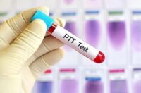 تست PTT آزمایش خون یا زمان نسبی ترومبوپلاستین؛ کاربردها و مقدار نرمال