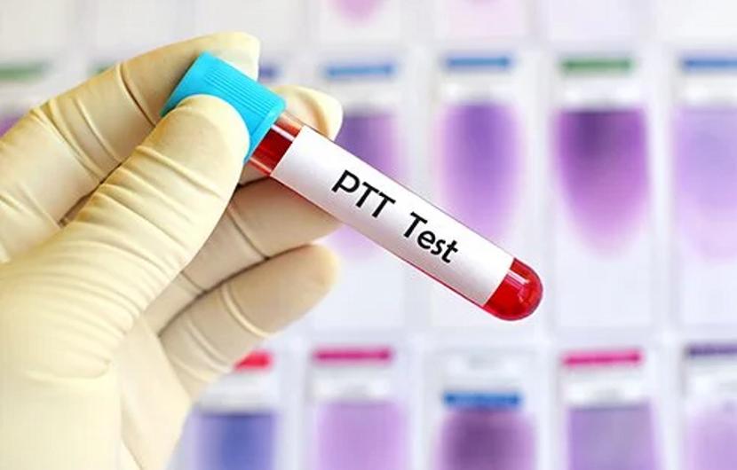 تست PTT
