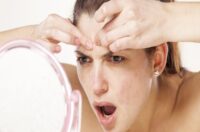 از بین بردن جوش