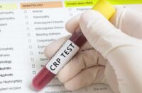 آزمایش CRP چیست؟