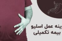 بیمه تکمیلی چقدر از هزینه عمل اسلیو را میدهد