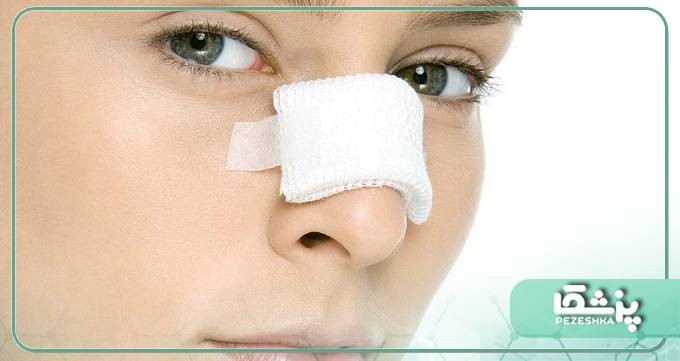 هزینه جراحی بینی استخوانی