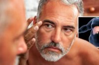 آیا برای علائم کبد چرب روی پوست حتما باید به متخصص پوست مراجعه کنیم؟