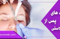 مراقبت های پس از بلفاروپلاستی