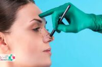 بهترین جراح بینی شیراز را چگونه پیدا کنیم؟