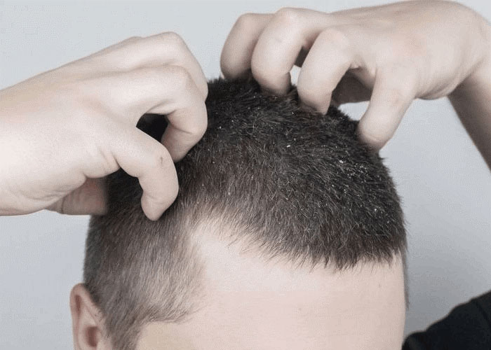4 ترفند خانگی برای پوست و مو