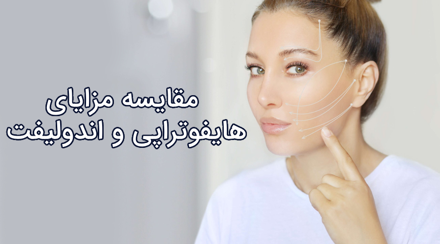 اندولیفت بهتر است یا هایفو؟