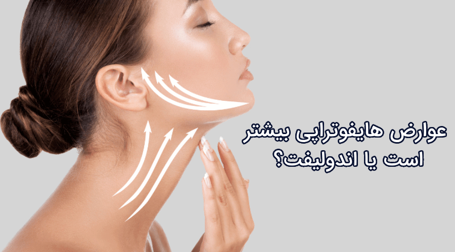 اندولیفت بهتر است یا هایفو؟