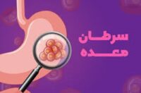 علل و علائم سرطان معده را بشناسید!