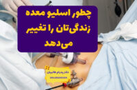 چطور اسلیو معده زندگی‌تان را تغییر می‌دهد