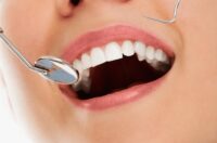 ۵ اشتباهی که میتواند سلامت دندانهایتان را نابود کند