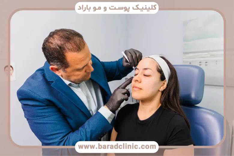 کنترل تورم بعد از انجام عمل بلفاروپلاستی
