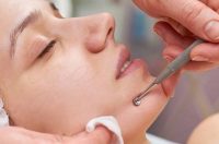 چگونه جوش‌های سر سیاه را از بین ببریم؟